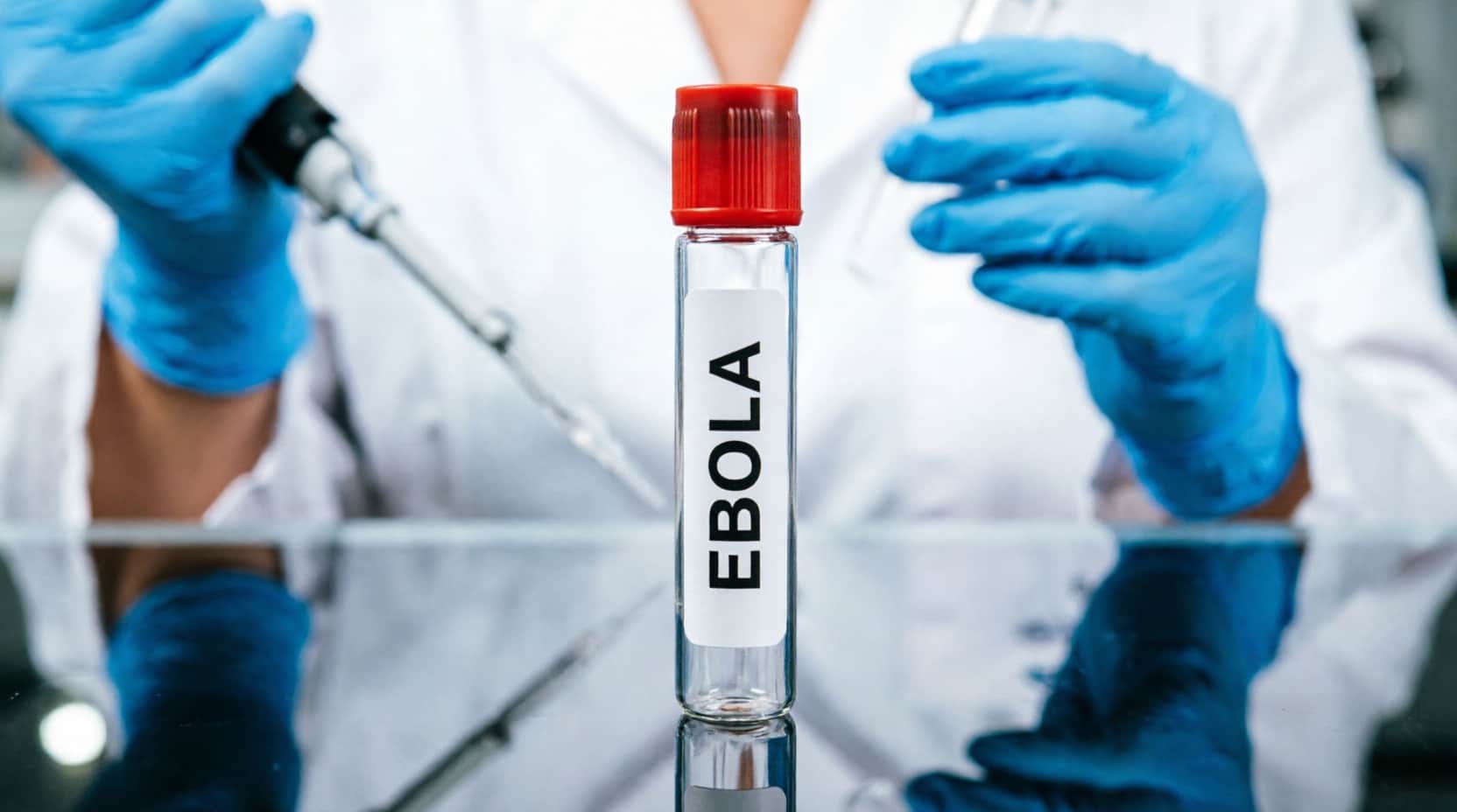 Imagen de OMS anuncia ensayos de dos tratamientos contra el ébola