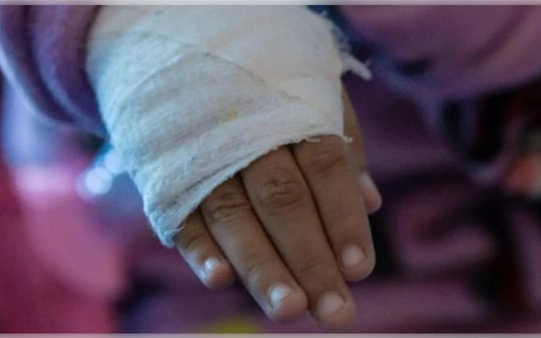 Cifras en rojo para Cundinamarca: La pirotecnia deja un rastro de urgencias en diciembre