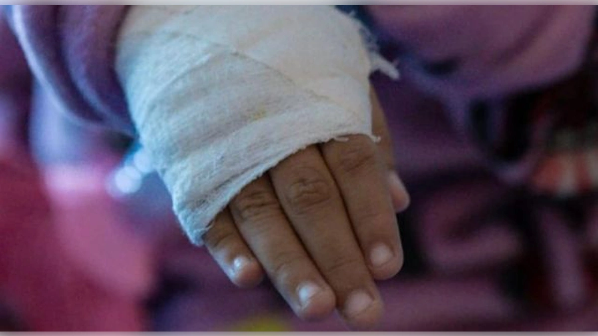 Cifras en rojo para Cundinamarca: La pirotecnia deja un rastro de urgencias en diciembre